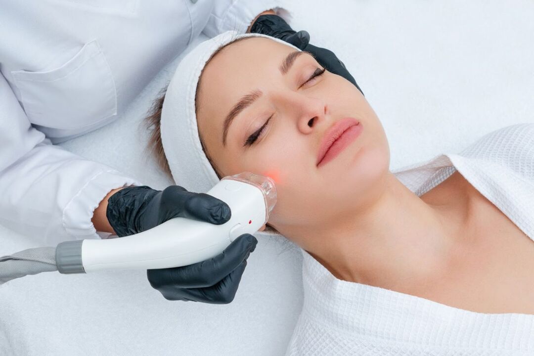 întinerire facială cu laser