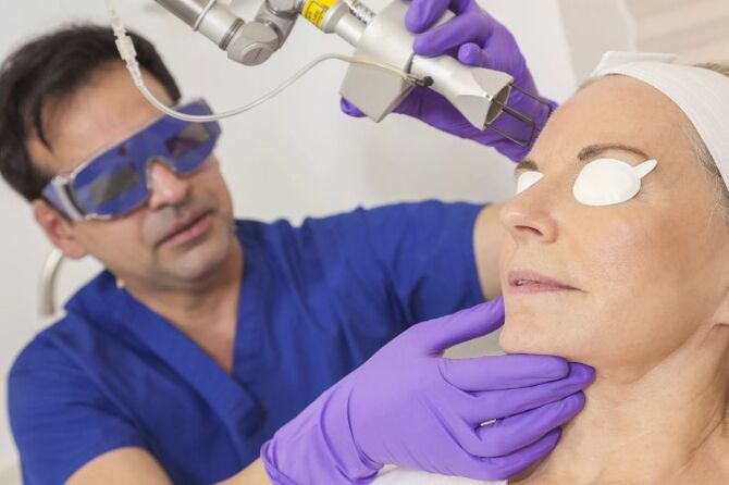Întinerirea pielii cu un laser